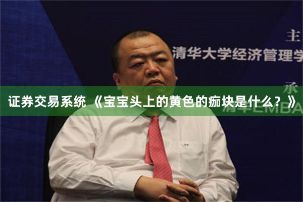 证券交易系统 《宝宝头上的黄色的痂块是什么？》